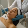 Fractional radiofrequency with PDRN treatment in Orlando